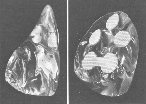 Brief History of Breast Implants - 1